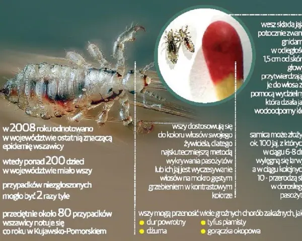 Czy farba zabija wszy? Prawda o gnidach i bezpieczne leczenie