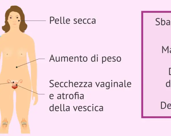 Sintomi della menopausa precoce: vampate, pelle secca, aumento di peso, calo del desiderio, mal di testa, disturbi del sonno e depressione.