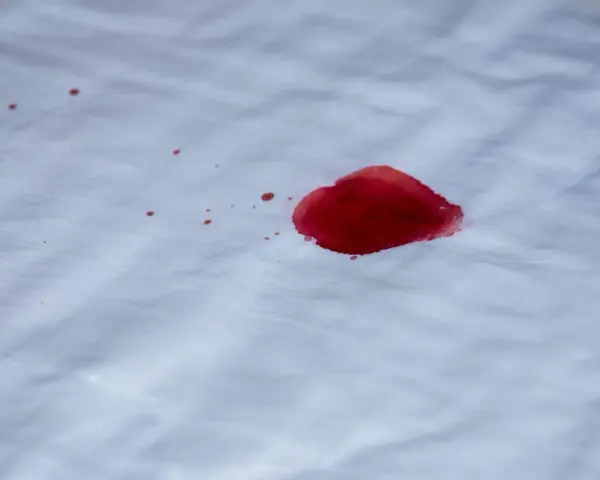 Une tache de sang rouge vif sur un tissu blanc. L'eau oxygénée pourrait aider à nettoyer cette tache.