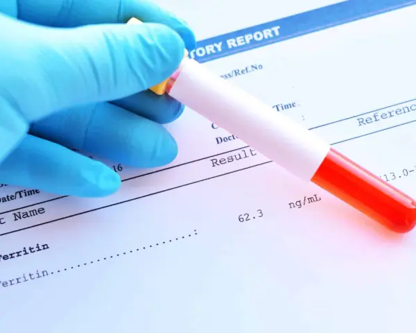Ręka w niebieskiej rękawiczce trzyma probówkę z krwią nad raportem laboratoryjnym. Wynik testu na **ferratynę** wynosi 62.3 ng/mL.