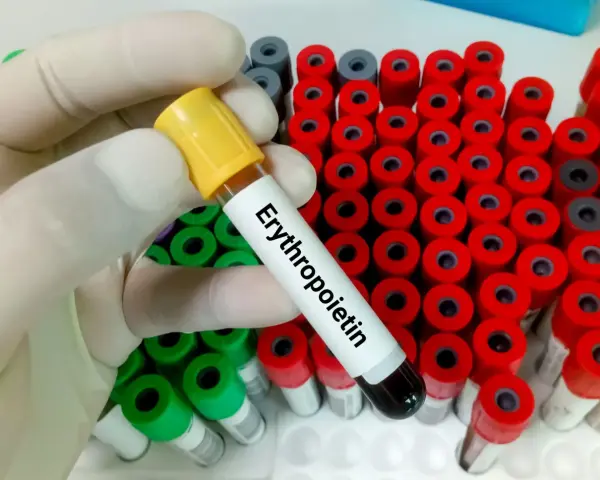 Ręka w rękawiczce trzyma probówkę z napisem "Erytropoetyna" na tle wielu innych probówek.