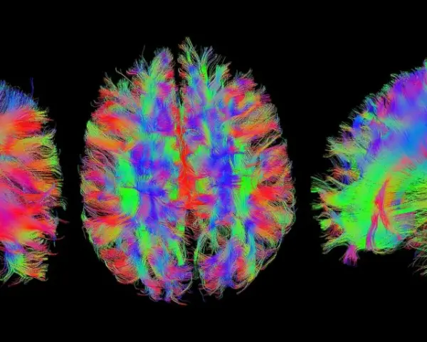 Bunte Faserbahnen des Gehirns, die die komplexen Verbindungen für kognitive Wissenschaft darstellen.