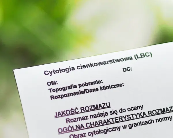 Wynik cytologii cienkowarstwowej (LBC). Dokument porównuje cytologię płynną a zwykłą, oceniając jakość rozmazu.