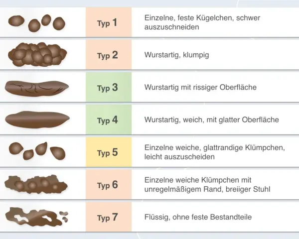 Stuhlformen von Typ 1 (hart, klumpig) bis Typ 7 (flüssig). Bei keinem Stuhlgang ab wann bedenklich? Die Grafik zeigt verschiedene Stuhltypen.