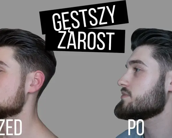 Jak przyspieszyć zarost? Ekspert radzi, co naprawdę działa.