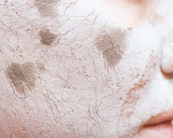 Textura agrietada de una mascarilla de arcilla sobre la piel, mostrando cómo protege la barrera cutánea.