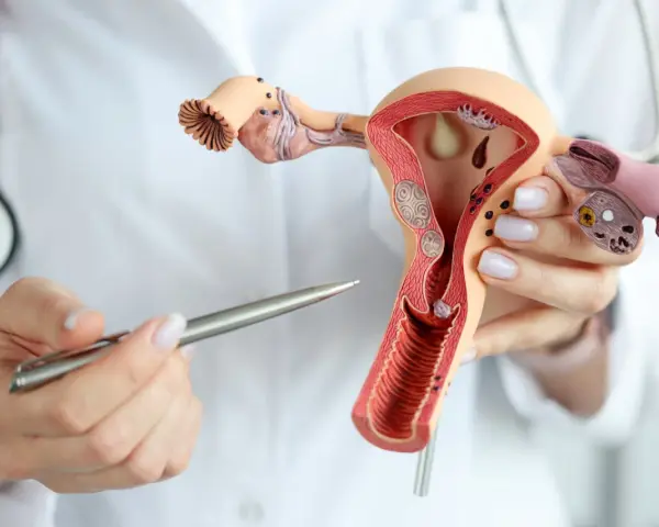 Model anatomiczny narządów rodnych kobiety z widocznym tyłozgięciem macicy i mięśniakami. Lekarz wskazuje na zmiany.