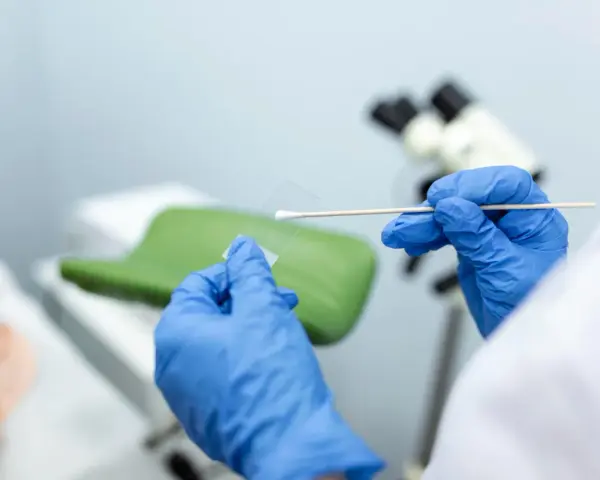 Ręce w niebieskich rękawiczkach przygotowują próbkę do badań cytologia wyniki. W tle mikroskop i fotel ginekologiczny.