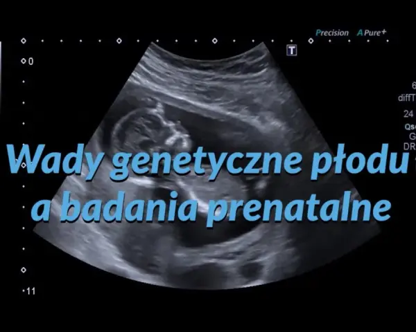 Badanie USG płodu, na którym widać plecy dziecka. Tekst: "Wady genetyczne płodu a badania prenatalne".