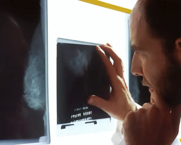 Lekarz analizuje mammografię, szukając oznak raka.