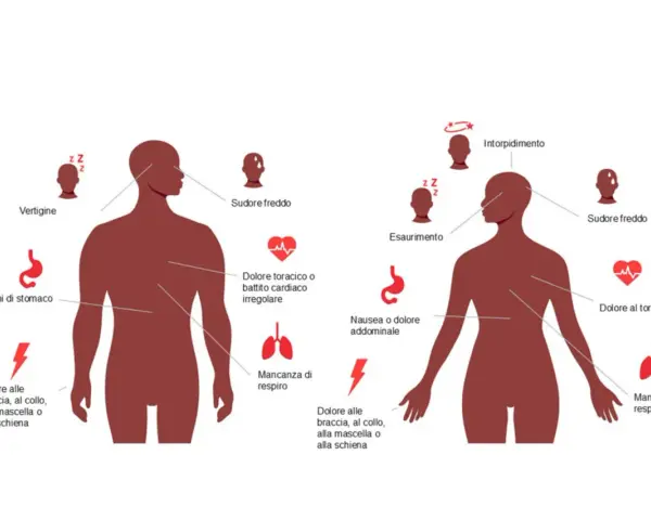 Sintomi infarto da stress: vertigini, sudore freddo, dolore toracico, nausea, intorpidimento, dolore a braccia/collo/mascella/schiena.