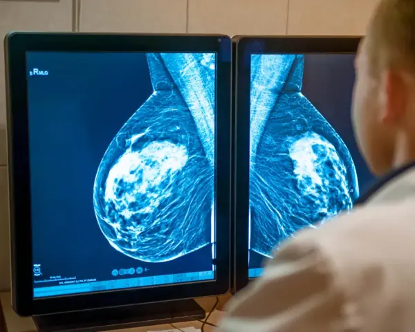 Lekarz analizuje mammografię piersi na ekranie. Wyniki badań, jak te z systemu armidex, są kluczowe dla wczesnego wykrywania.