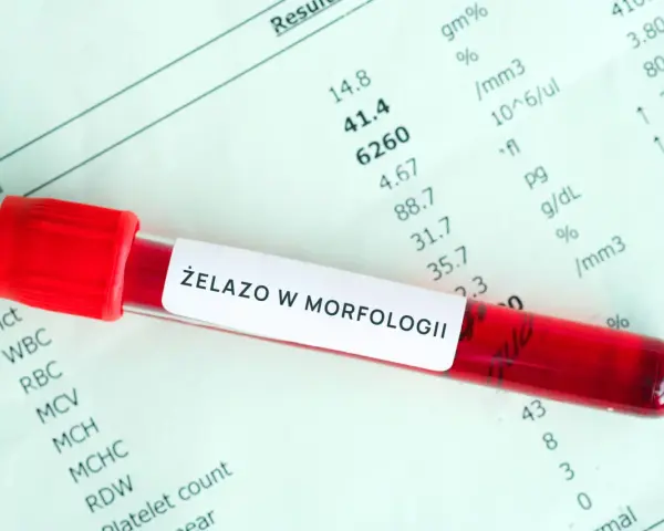Czerwona probówka z krwią na tle wyników morfologii krwi z oznaczeniem "Żelazo w morfologii".