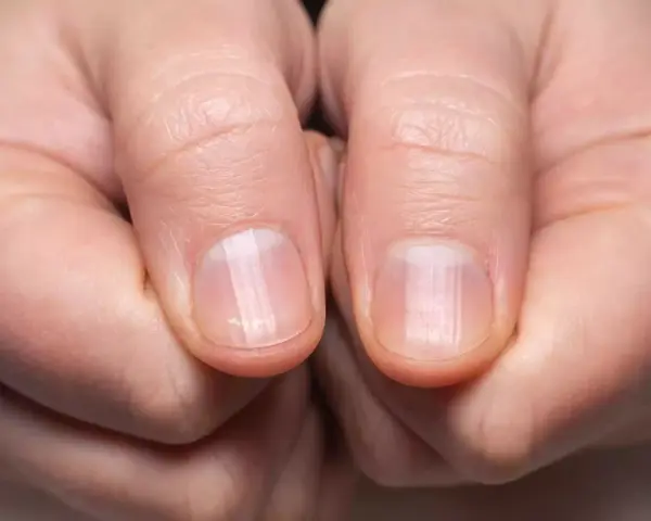 Des ongles fragiles ? Découvrez comment durcir les ongles recette de grand-mère pour des mains sublimes.