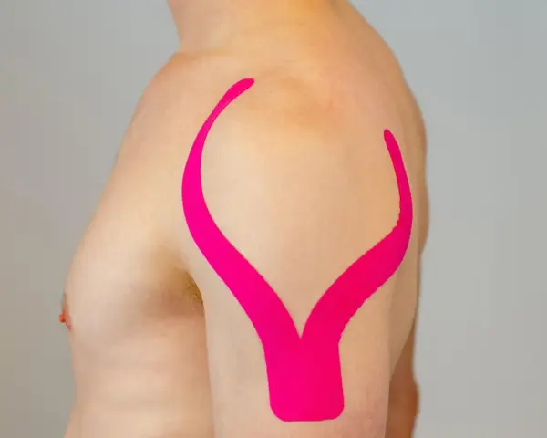 Schulter tapen: Ein Mann mit pinkem Kinesio-Tape auf der Schulter, das wie ein V geformt ist, zur Unterstützung.