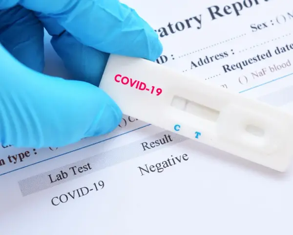 Rękawiczka w niebieskiej rękawiczce trzyma test na COVID-19 z negatywnym wynikiem. Zastanawiasz się, ile kosztuje test na covid?