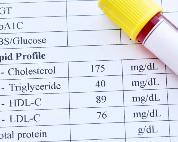 Wyniki lipidogramu wskazują na dyslipidemię: cholesterol 175, trójglicerydy 40, HDL-C 89, LDL-C 76 mg/dL.