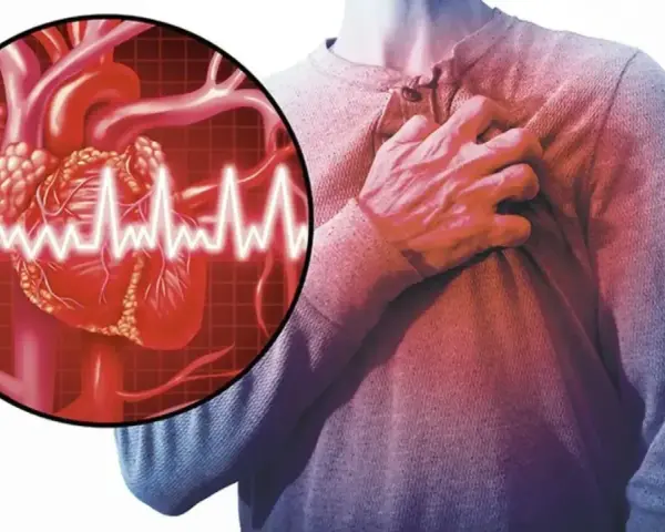 Człowiek trzymający się za klatkę piersiową, symbolizujący dusznicę bolesną. Obok grafika serca z zapisem EKG.