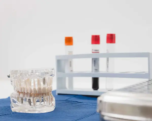 Model szczęki z implantami, probówki i sterylne pudełko. Precyzyjny konturing zębów w gabinecie stomatologicznym.