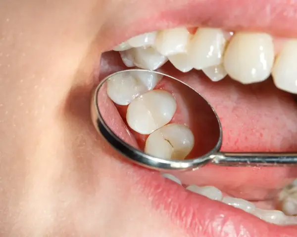 Znieczulenie u dentysty: czy jest bezpieczne? Fakty i mity