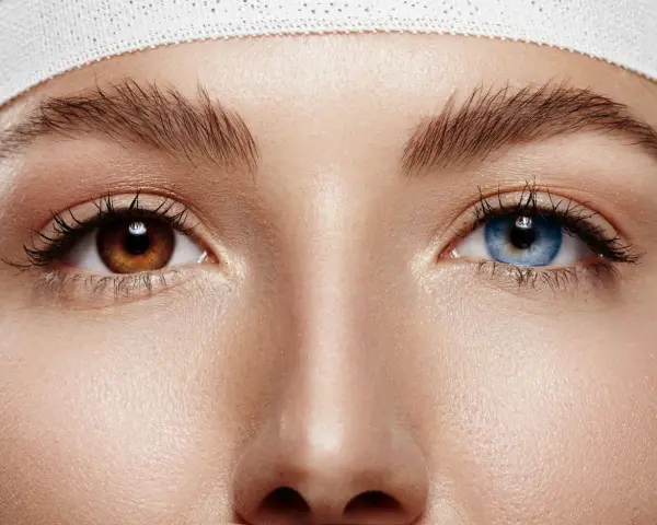Oczy z heterochromią: jedno brązowe, drugie niebieskie. Delikatna opaska na głowie.