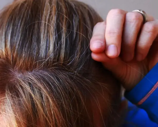 Dita che tirano i capelli, un gesto comune nella tricotillomania, a volte associata all'autismo.
