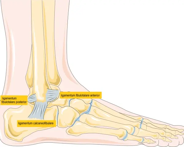 Illustration av fotens ledband: ligamentum fibulotalare posterior, ligamentum calcaneofibulare och ligamentum fibulotalare anterior.