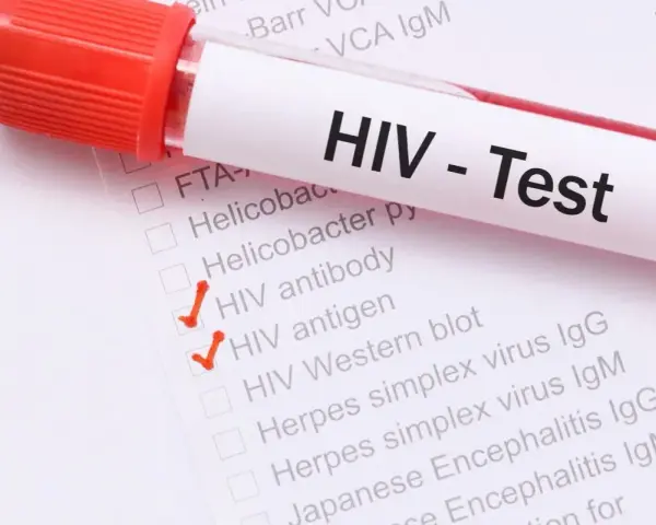Probówka z krwią do testu na HIV. Zaznaczone HIV antibody i HIV antigen.