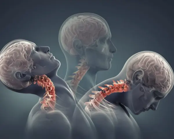 Symulacja urazu whiplash po polsku: gwałtowne ruchy głowy i szyi, ukazujące kręgosłup szyjny.
