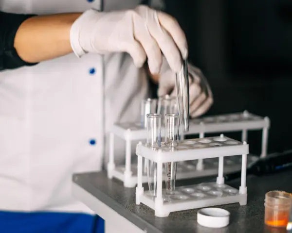Laborant med handskar hanterar provrör. Kanske för att ta testosteron eller analysera andra prover i labbet.