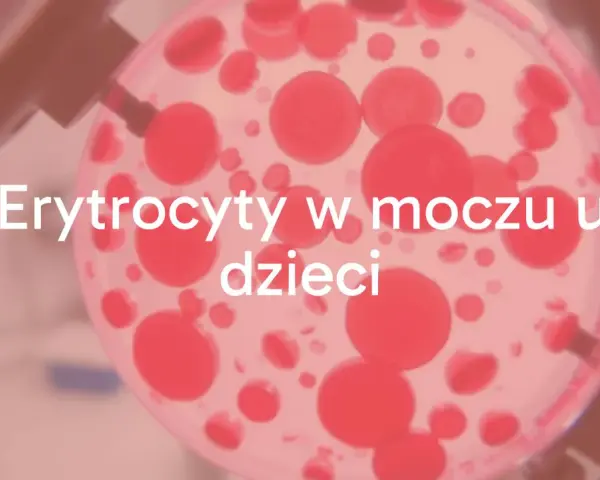Badanie moczu: ogólne czy posiew? Zrozum różnice i diagnozę