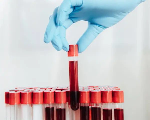 Ręka w niebieskiej rękawiczce trzyma probówkę z krwią. Czy w badaniu krwi wyjdzie nikotyna?