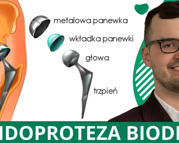 Jakie endoprotezy stawu biodrowego refunduje NFZ i ile kosztują?