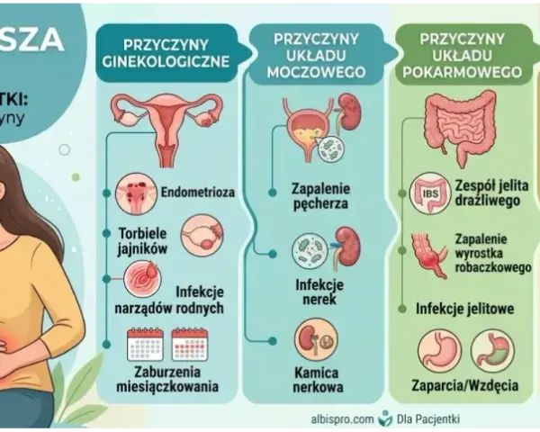 Ilustracja przedstawia przyczyny bólu brzucha i nietypowych krwawień u kobiet, od ginekologicznych po pokarmowe i inne.