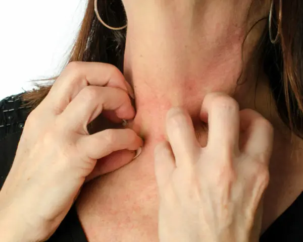 Allergie Parfum Symptome: So erkennen Sie die gefährlichen Anzeichen