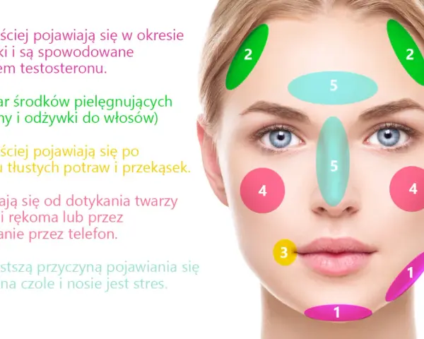 Dlaczego pryszcze wyskakują w tym samym miejscu? Sprawdź przyczyny