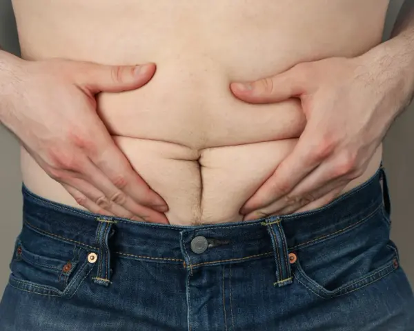 Mężczyzna ściska brzuch, uwidaczniając fałdy skóry i tkankę tłuszczową, co może sugerować cellulit u mężczyzn.