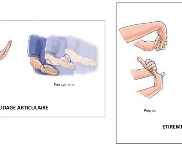 Exercices de mobilisation du poignet et du coude pour un épicondylite traitement naturel.