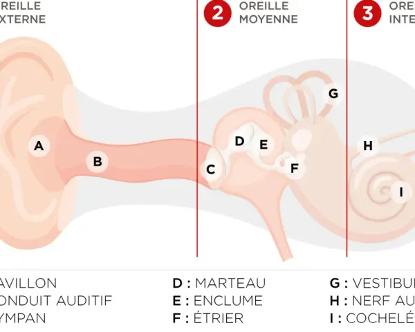 Schéma de l'oreille montrant les différentes parties. La cochlée (I) contient les cellules ciliées endommagées, essentielles à l'audition.