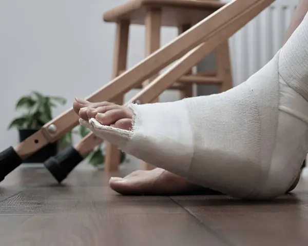 Noga w opatrunku, przygotowanie do rehabilitacji palca po złamaniu. Obok stoją kule.