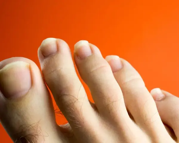 Primer plano de unos pies con uñas amarillas sobre fondo naranja.