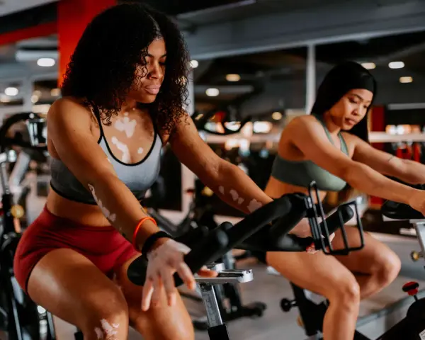 Two women are engaged in a stationary bike workout in a gym. The woman in the foreground has vitiligo and curly hair.
