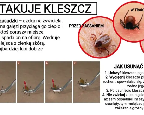 Kleszcz pod skórą to mit! Jak rozpoznać i bezpiecznie usunąć?
