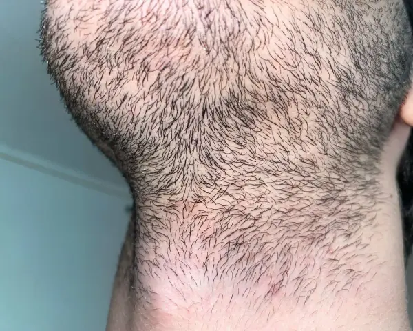 Barba incipiente y cuello con vello corto. Para una piel suave, es bueno afeitarse todos los días.