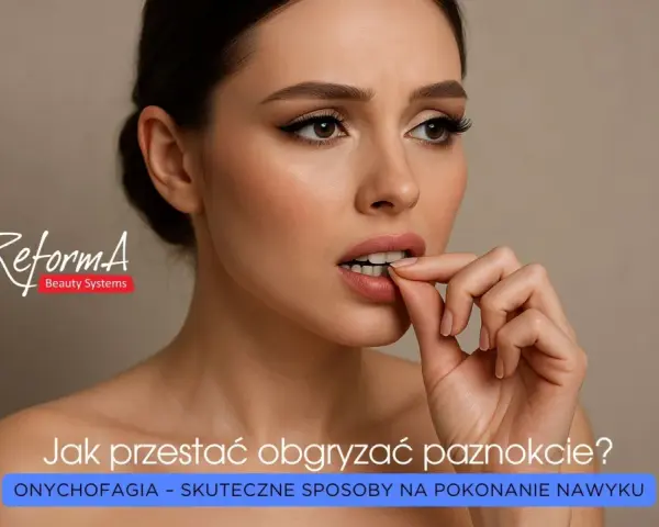 Kobieta z obgryzionymi paznokciami, symbol **onychofagii**. Tekst: "Jak przestać obgryzać paznokcie? Onychofagia - skuteczne sposoby na pokonanie nawyku.