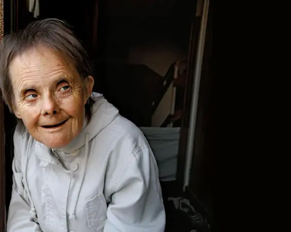 Portret kobiety z zespołem Downa w jasnej kurtce, patrzącej w bok.