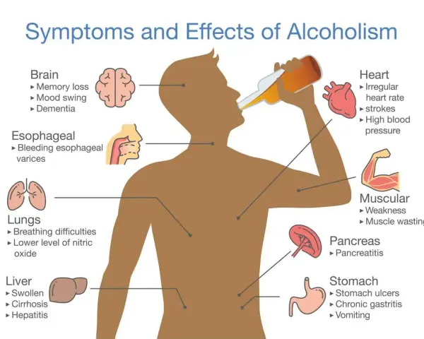 Ilustracja pokazuje skutki picia alkoholu: problemy z mózgiem, sercem, płucami, wątrobą, żołądkiem i mięśniami.