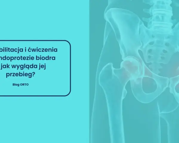 Rehabilitacja po endoprotezie biodra: Jak odzyskać pełną sprawność?