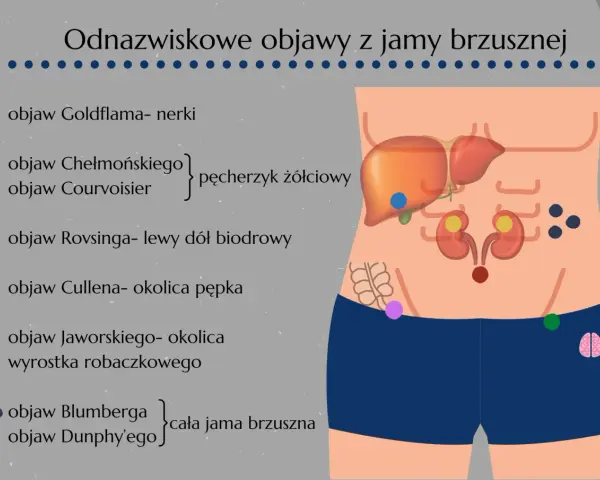 Objaw Rovsinga zaznaczony zieloną kropką w lewym dole biodrowym, ilustrujący objawy z jamy brzusznej.