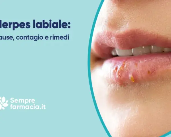 Herpes labiale: cause, contagio e rimedi. Scopri come curare l'herpes labiale e alleviare i sintomi.